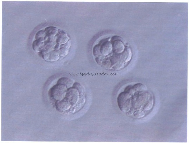 FET embryos - www.MePlus3Today.com